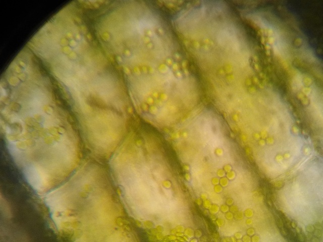 黑藻细胞(绿色小颗粒为叶绿体)